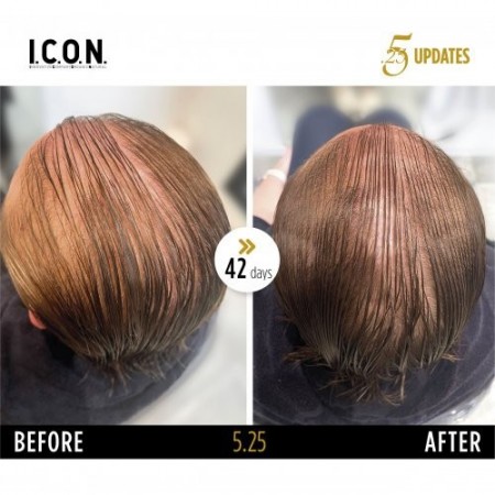 Icon Hair Regenerator 5,25 Plaukų augimą skatinantis serumas  100ml